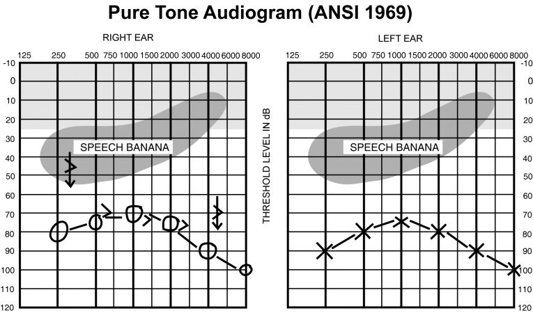 Media Name: audiogram_5bconverted5d.jpg